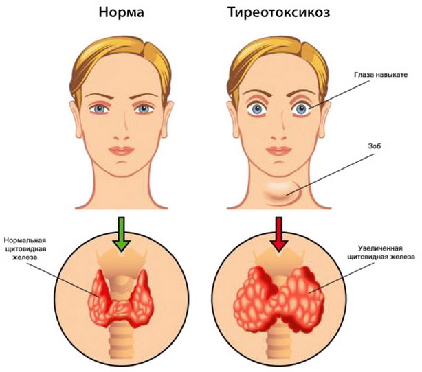 антитела к тпо норма